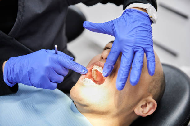 Best Emergency Dental Filling Replacement  in Cloverport, KY